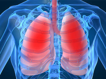 Baltimore Lung Injury Lawyer