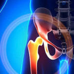 Pelvic Injury