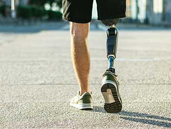 Conceptual image representing amputation or loss of limb due to catastrophic accidents.